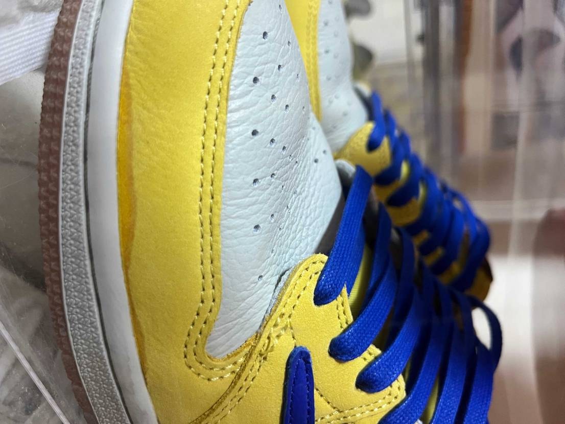 このシミってなんですか😱
心当たり無いんですけど左右同じ場所に同じようなシミが