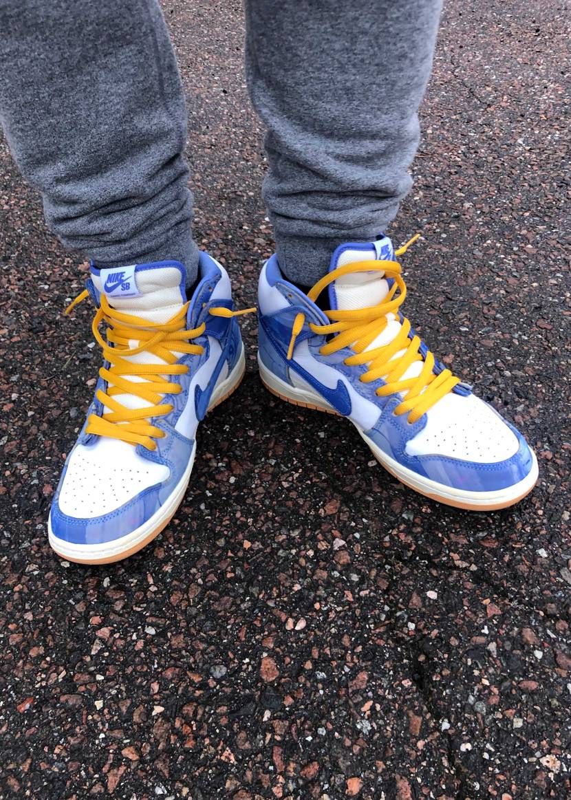 ちょっと迷ったけどーーー
やっぱり黄色やー😆