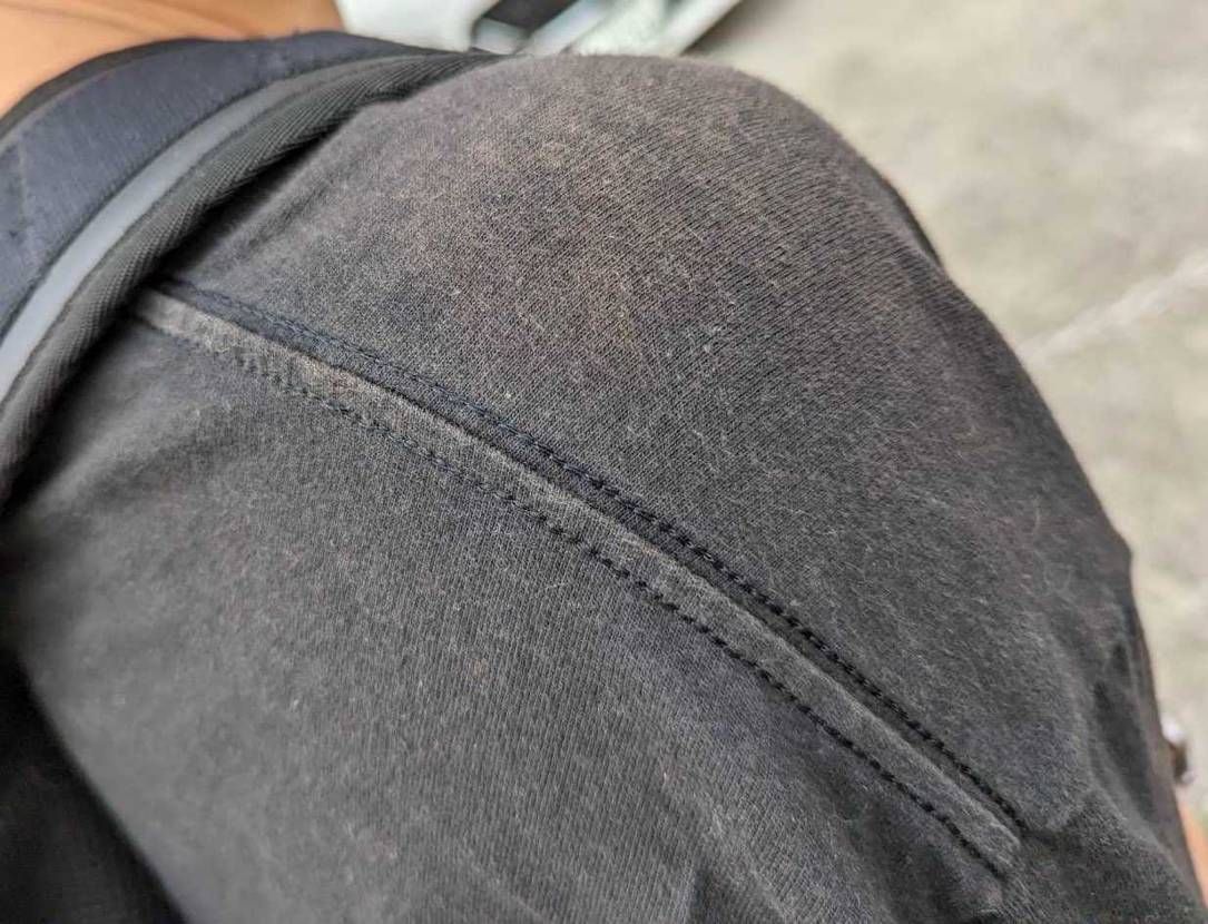 黒tの赤い
日焼け？
擦れ？
これって対処方ないですかね