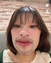  ANH