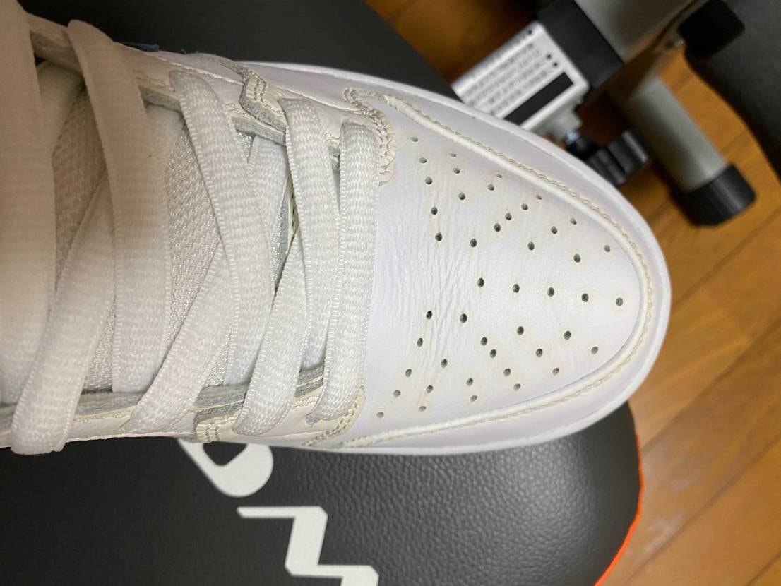 このような黄ばみはどうしたら取れますか？
教えてください！