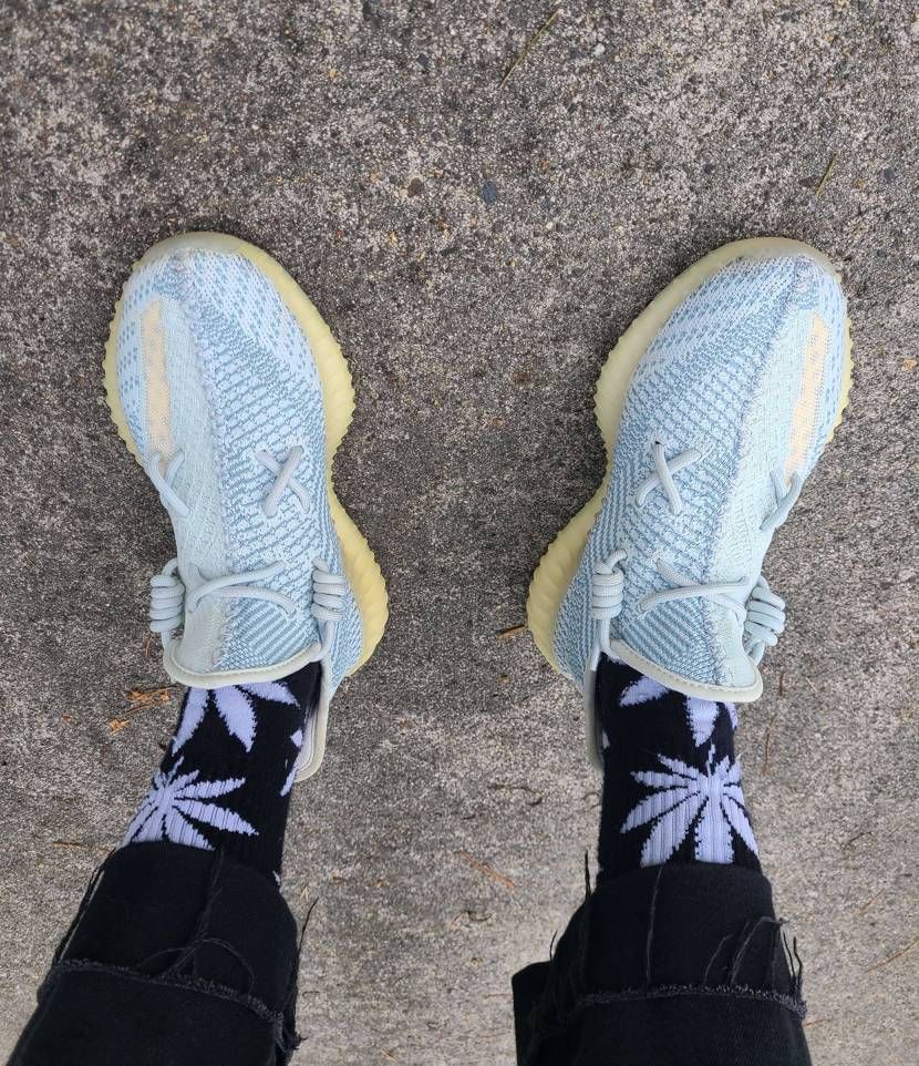 すんごい黄ばんでしまって…手入れ雑すぎたかな