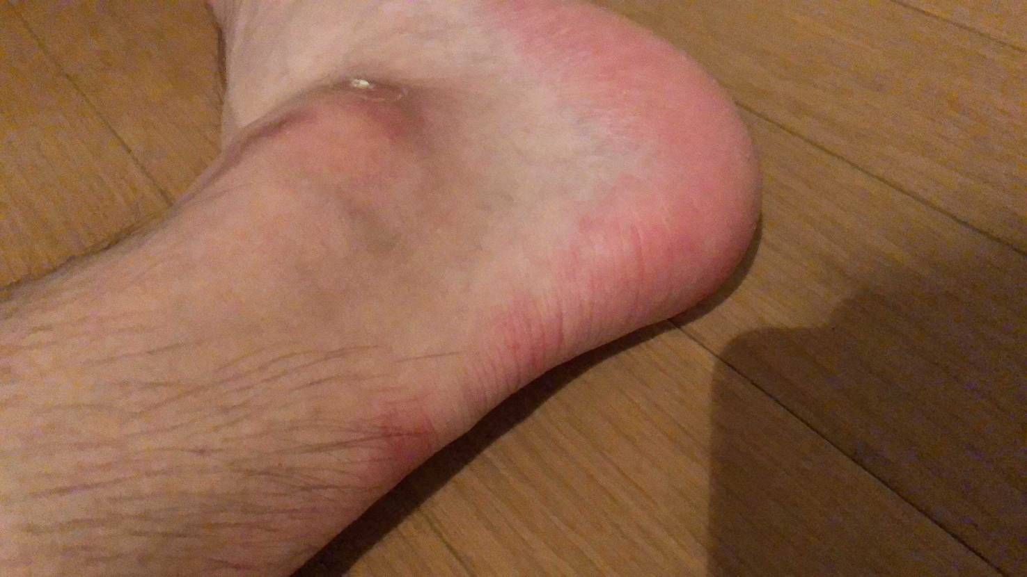 汚ったない足晒して、申し訳御座いません🙇‍♂️
お気に入りのスニーカー履くのも